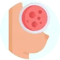 breast