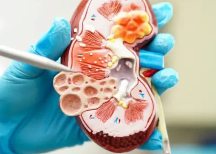 Nephrology-imgB1-480x576