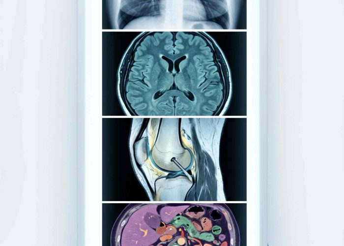 radiology_11zon